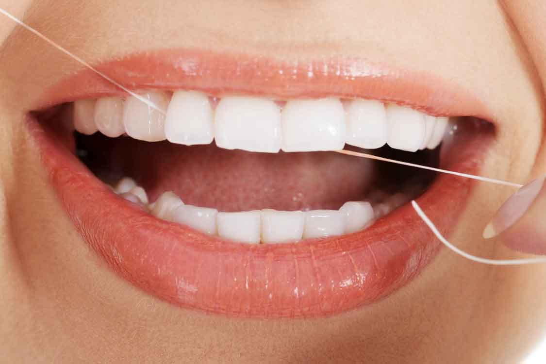 Importância do fio dentário na higiene oral