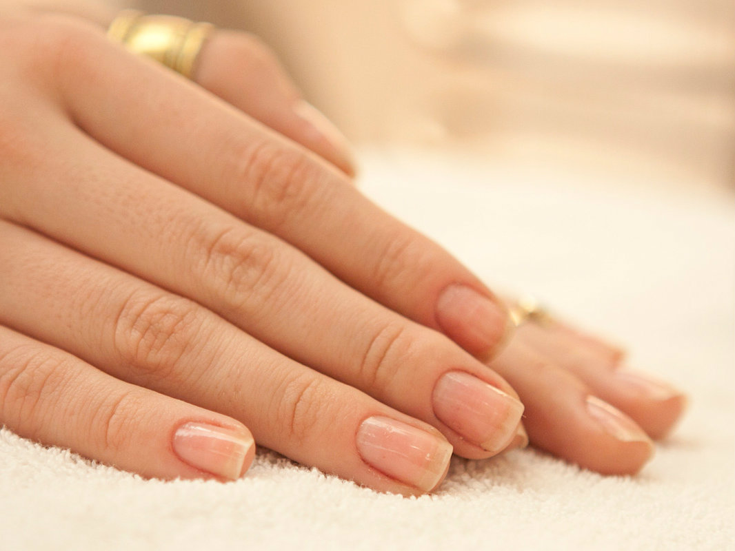 O aspeto das unhas pode indicar se temos doenças?