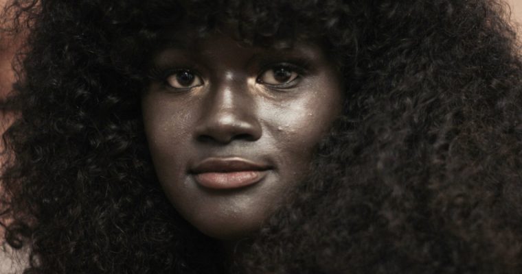 Uma vítima de bullying que se tornou uma modelo de sucesso