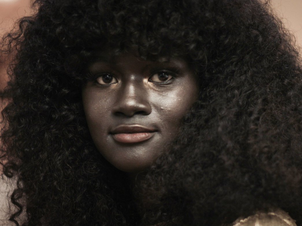 Uma vítima de bullying que se tornou uma modelo de sucesso