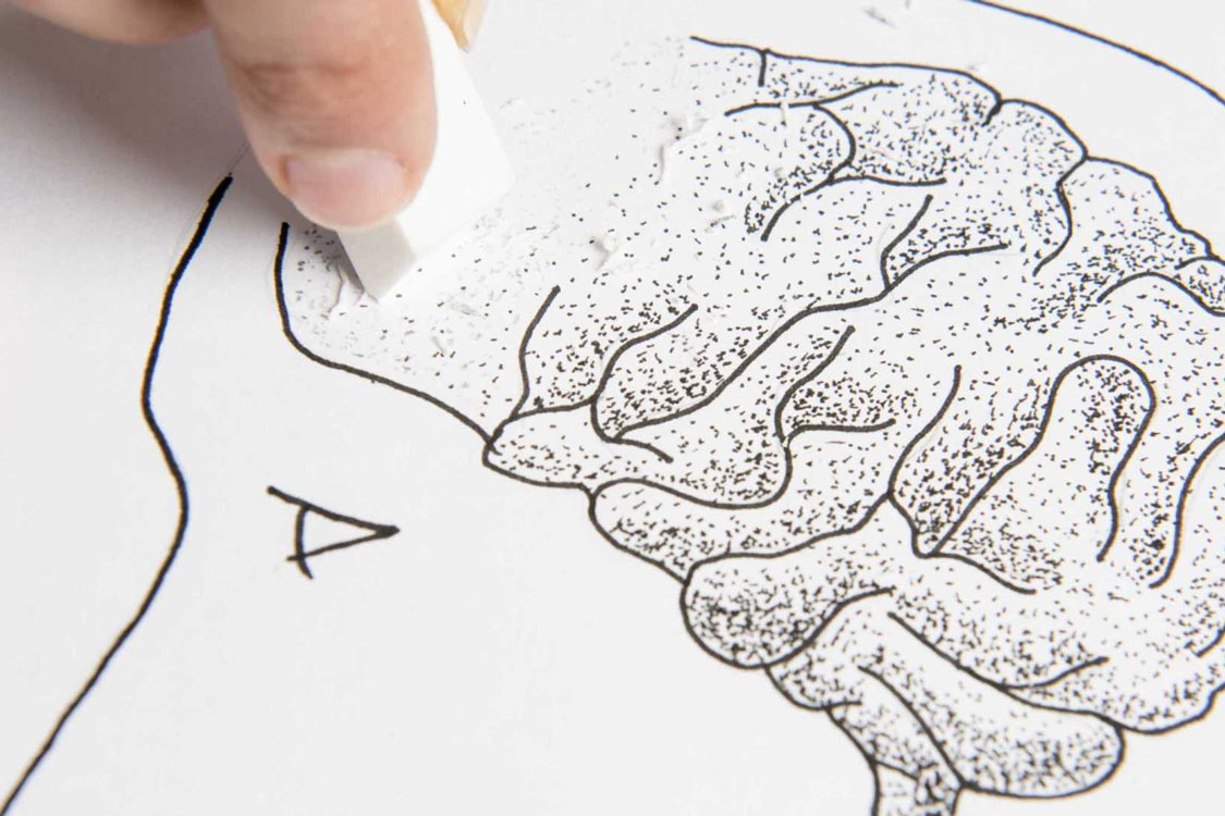 6 alimentos que deve comer para evitar ter Alzheimer