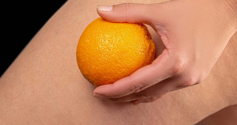 A sua pele agradece: quatro alimentos que lutam contra a celulite!